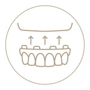 orny odontologia PROTESES DENTARIAS