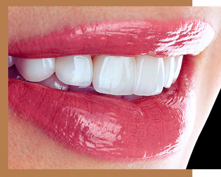 calreamento dental em campinas orny odontologia